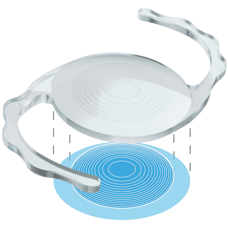 Sulcoflex Trifocal - Image 2