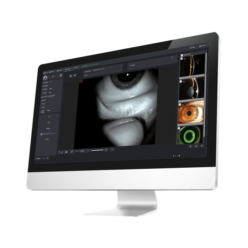 S390L New Digital Slit Lamp Dry Eye - Image 3