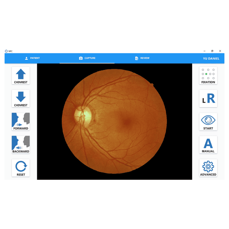 Non-mydriasis fundus kamera - Image 6