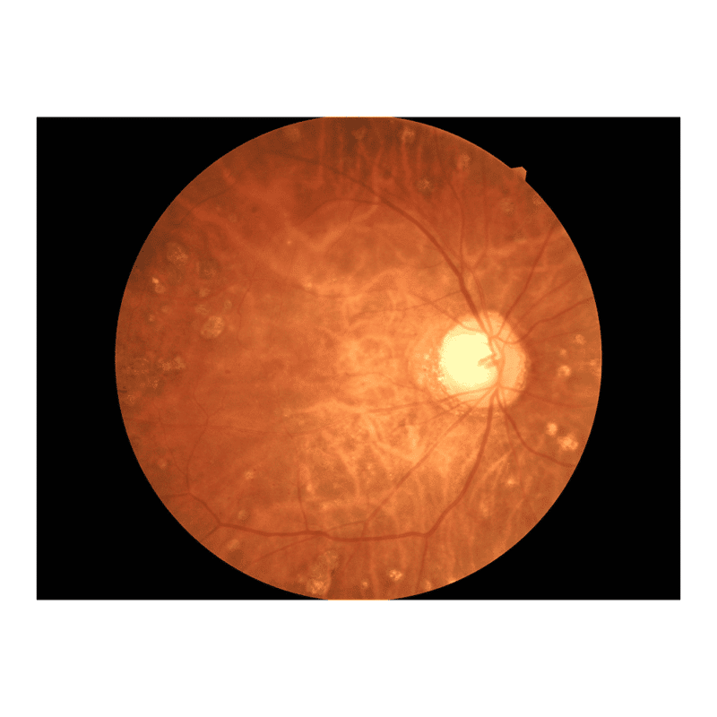 Non-mydriasis fundus kamera - Image 5