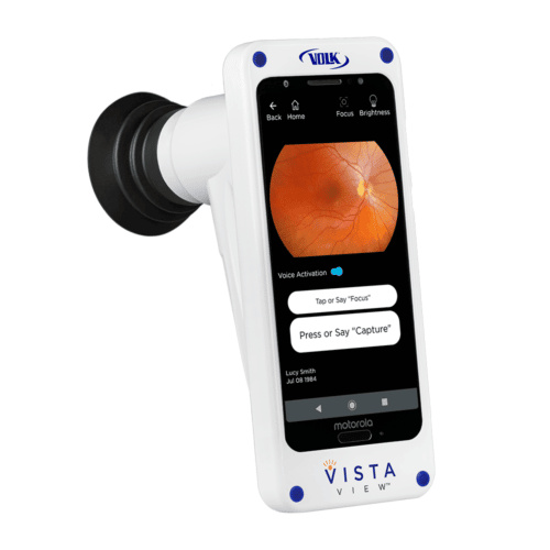 VistaView
